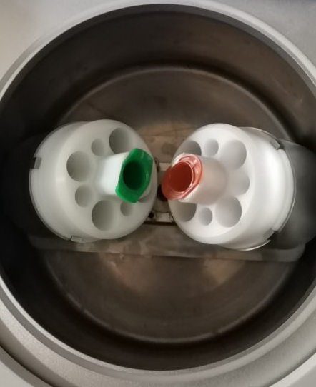 脫泡機,真空脫泡機,真空攪拌脫泡機,真空攪拌脫泡機